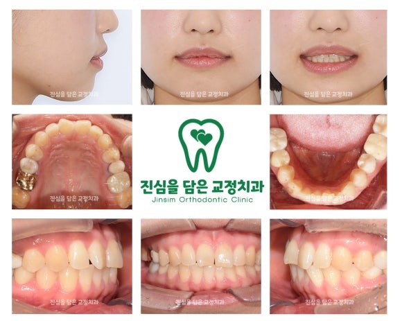 초진사진 (1).jpg