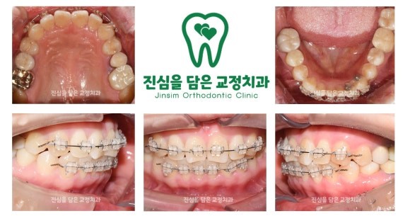 진료과정-1.jpg