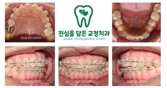 진료과정-2.jpg