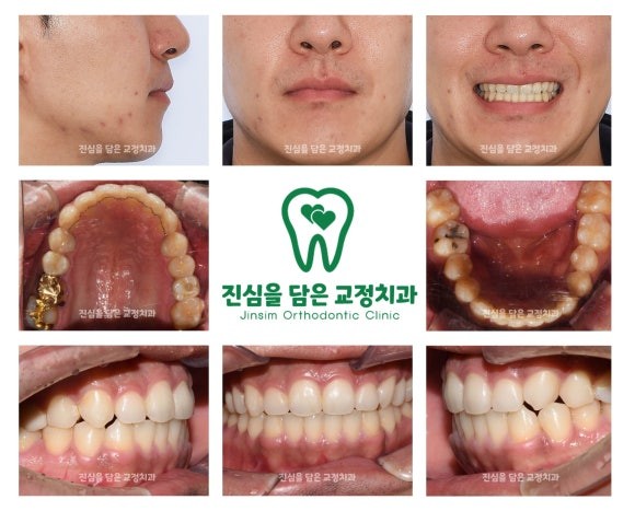 마무리.jpg