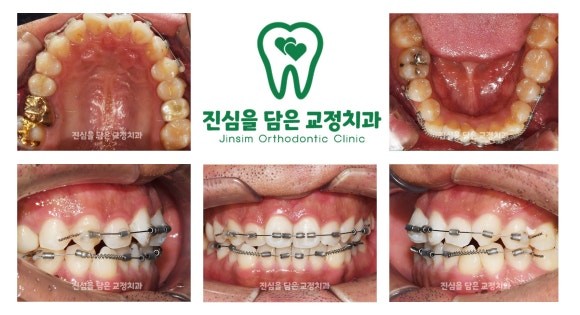 진료과정-1.jpg