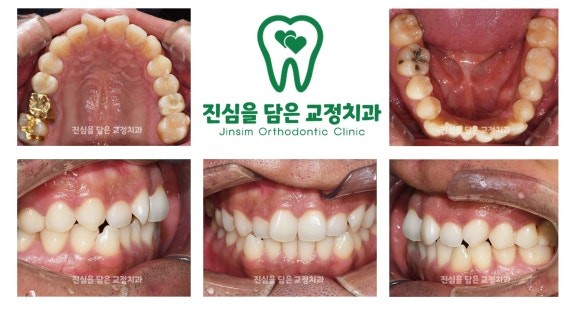 초진사진_-_복사본_최종.jpg