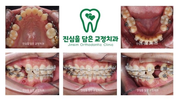 진료과정-1.jpg