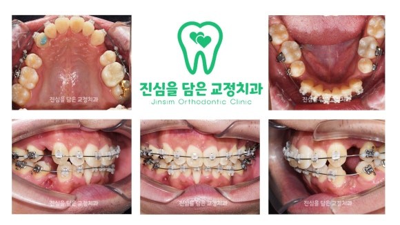 진료과정-2.jpg