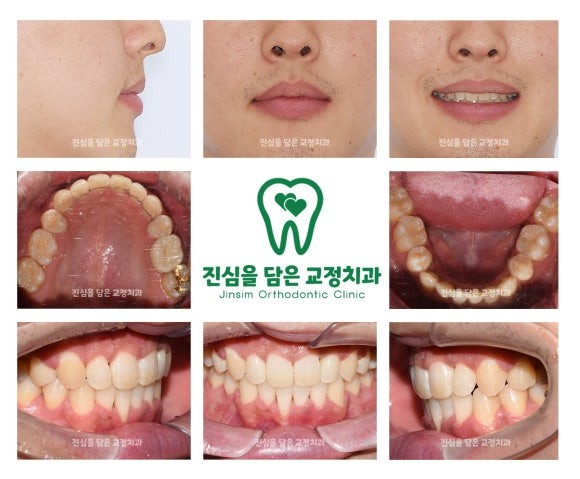 마무리.jpg