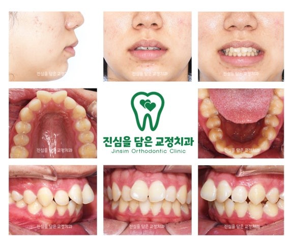 초진사진.jpg