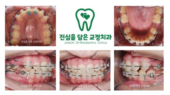 진료과정-1.jpg