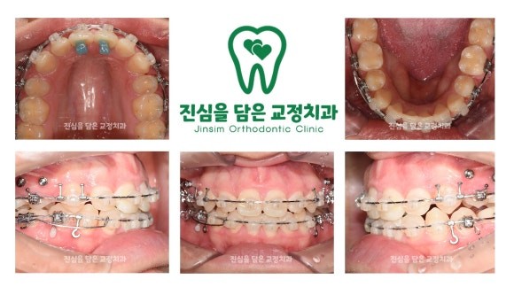 진료과정-2.jpg