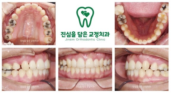 5 진행과정2.jpg
