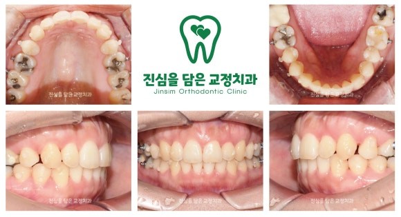 6 진행과정3.jpg