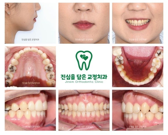 8 마무리.jpg