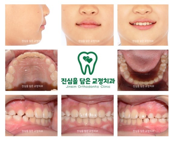 4 마무리.jpg