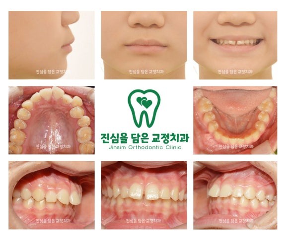 1 초진사진.jpg
