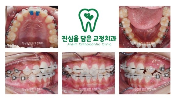 진료과정-1.jpg
