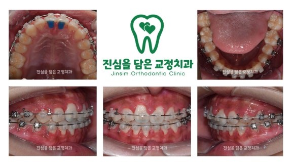 진료과정-2.jpg
