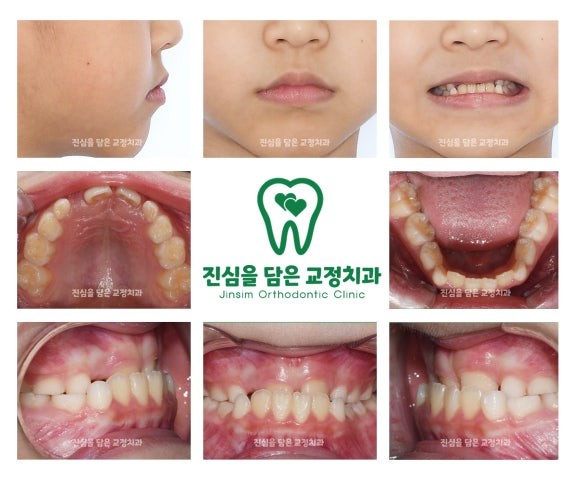 초진사진 (1).jpg