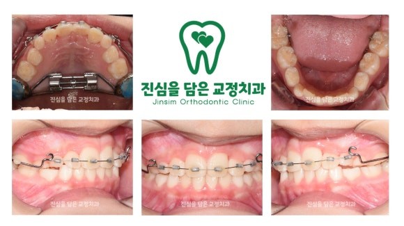 진료과정-2.jpg