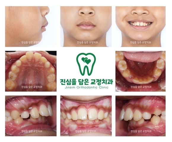 초진사진.jpg