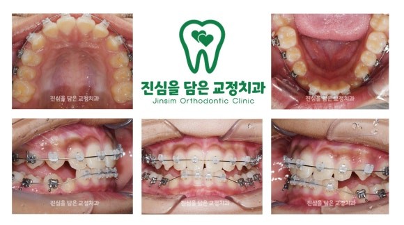 진료과정-1.jpg