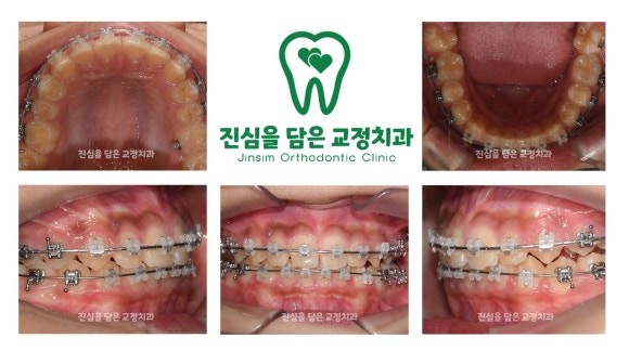 진료과정-2.jpg
