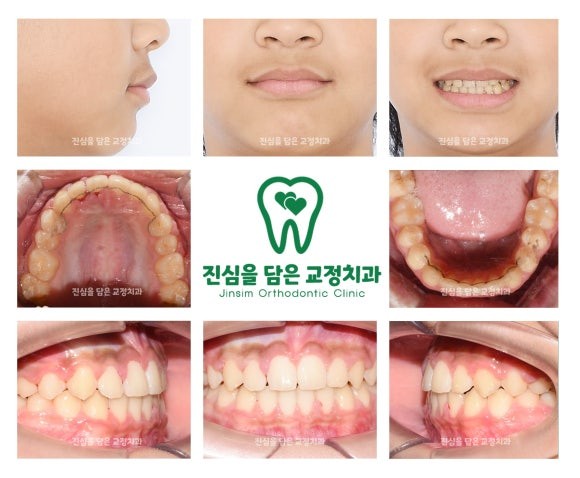 마무리.jpg