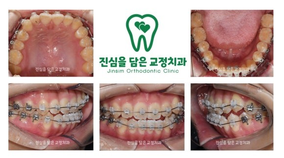 진료과정-1.jpg