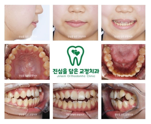 초진사진.jpg